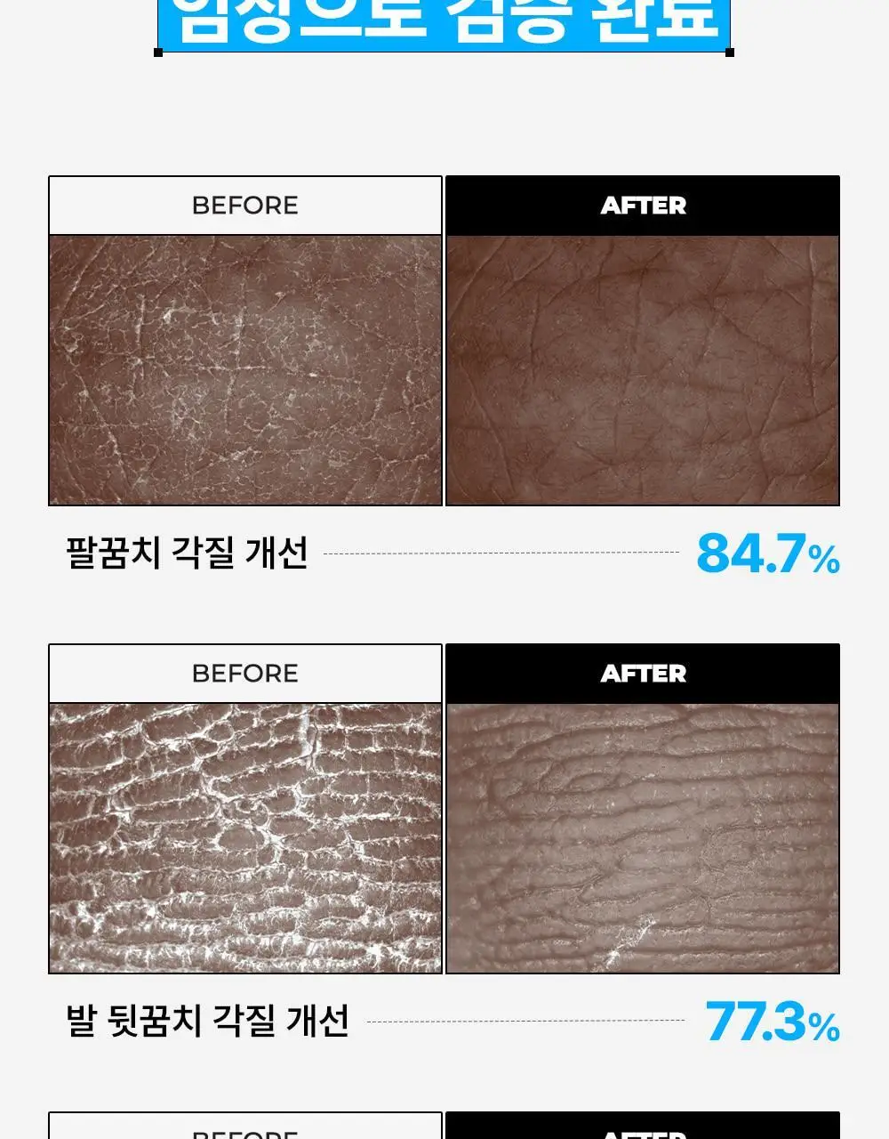[NEW] 닥터빼 꿀꿈치 패치 1set * 4매 상세페이지 15